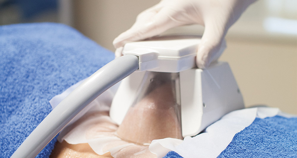 Multiple Areas in One Session HIFU and Fat Freezing Banstead